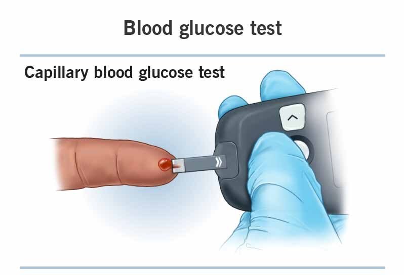 Understanding Blood Sugar: Why Natural Sweeteners Matter